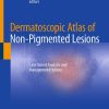 Dermatoscopic Atlas of Non-Pigmented Lesions (PDF)