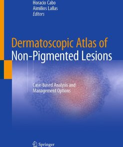 Dermatoscopic Atlas of Non-Pigmented Lesions (PDF)