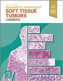 Diagnostic Pathology: Soft Tissue Tumors, 4th Edition