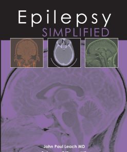 Epilepsy Simplified (ePub Book)