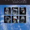 Fetal Cardiology Simplified (EPUB)