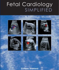 Fetal Cardiology Simplified (EPUB)