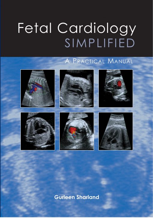 Fetal Cardiology Simplified (EPUB)