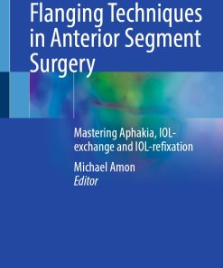 Flanging Techniques in Anterior Segment Surgery (ePub Book)