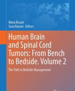 Human Brain and Spinal Cord Tumors: From Bench to Bedside. Volume 2 (ePub Book)