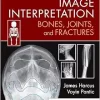 Image Interpretation: Bones, Joints, and Fractures (PDF)