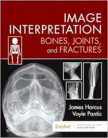 Image Interpretation: Bones, Joints, and Fractures (PDF)