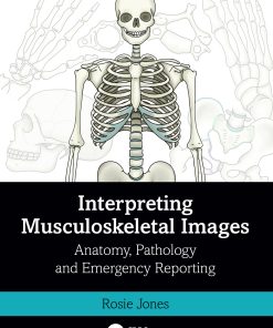 Interpreting Musculoskeletal Images (ePub Book)