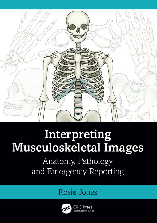 Interpreting Musculoskeletal Images (ePub Book)