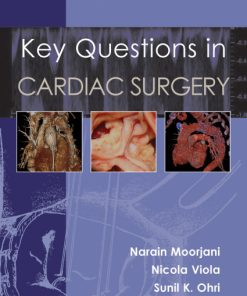 Key Questions in Cardiac Surgery (ePub Book)