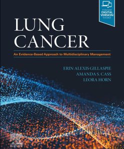 Lung Cancer: An Evidence-Based Approach to Multidisciplinary Management (ePub Book)