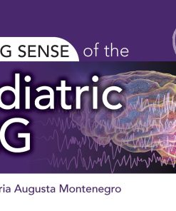 Making Sense of the Pediatric EEG (ePub Book)