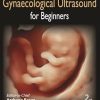 Obstetrics and Gynaecological Ultrasound for Beginners, 2nd Edition