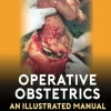 Operative Obstetrics: An Illustrated Manual