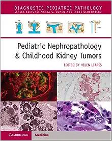 Pediatric Nephropathology & Childhood Kidney Tumors (Diagnostic Pediatric Pathology) (PDF)