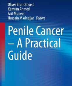 Penile Cancer – A Practical Guide (PDF)