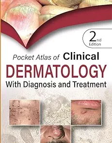 Pocket Atlas of Clinical Dermatology with Diagnosis and Treatment, 2nd Edition