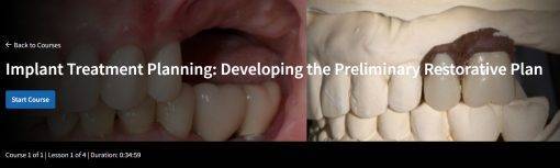 Spear-Implant Treatment Planning: Developing the Preliminary Restorative Plan