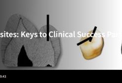 Spear-Posterior Composites: Keys to Clinical Success Part 1