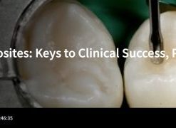 Spear-Posterior Composites: Keys to Clinical Success, Part 2