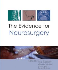 The Evidence for Neurosurgery (EPUB Book)