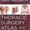 Thoracic Surgery Atlas, 2nd edition (EPUB)