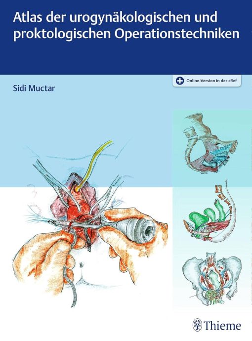 Atlas der urogynäkologischen und proktologischen Operationstechniken (PDF)