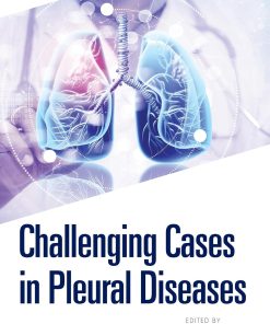 Challenging Cases in Pleural Diseases (PDF)