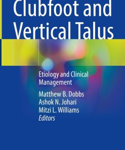 Clubfoot and Vertical Talus (PDF)