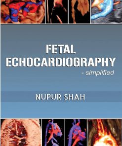 Fetal Echocardiography – Simplified (azw3+ePub+Converted PDF)