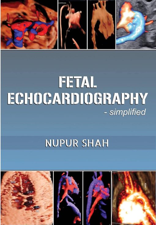 Fetal Echocardiography – Simplified (azw3+ePub+Converted PDF)