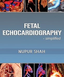 Fetal Echocardiography – Simplified (Azw3 + epub + Convert PDF)