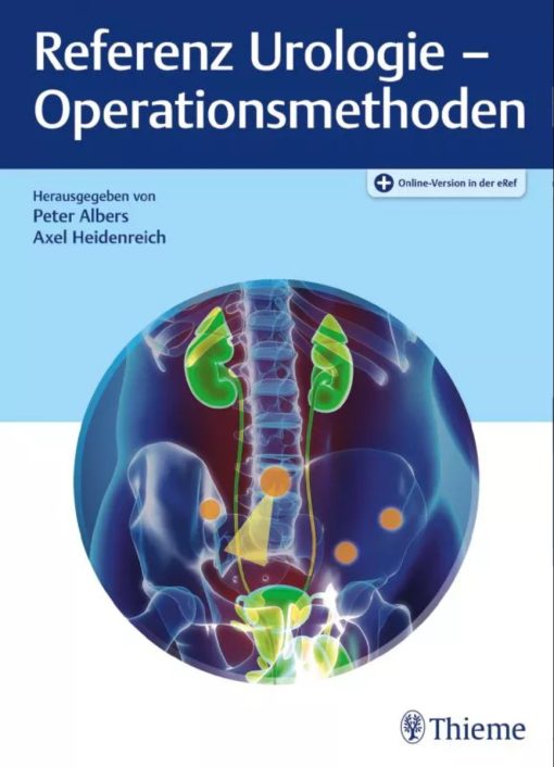 Referenz Urologie – Operationsmethoden (PDF)