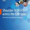 Shoulder Arthritis across the Life Span (PDF)