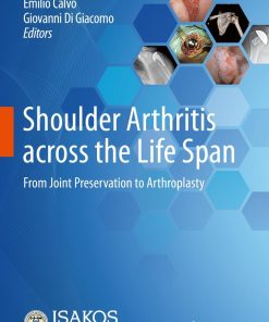 Shoulder Arthritis across the Life Span (PDF)