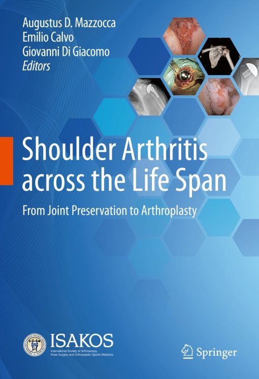 Shoulder Arthritis across the Life Span (PDF)