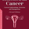 Endometrial Cancer: Current Epidemiology, Detection and Management (Second Editio) (PDF)