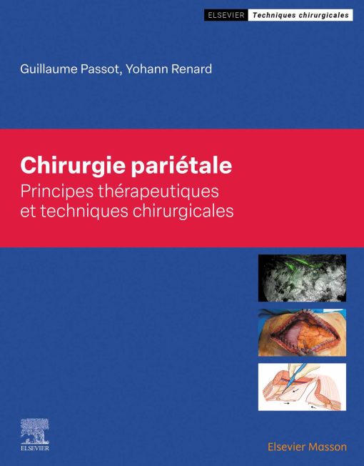 Chirurgie pariétale (PDF)