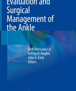 Evaluation and Surgical Management of the Ankle (PDF)