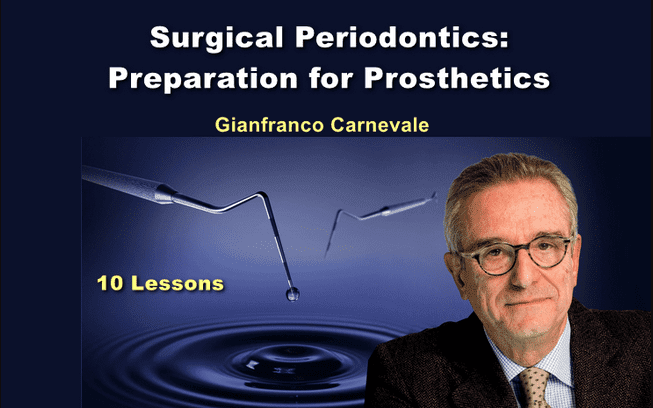 OHI-S Surgical periodontics: preparation for prosthetics (Course)