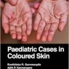 Paediatric Cases in Coloured Skin (PDF)