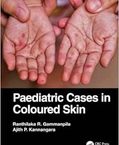 Paediatric Cases in Coloured Skin (PDF)