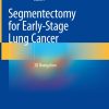 Segmentectomy for Early-Stage Lung Cancer (PDF)