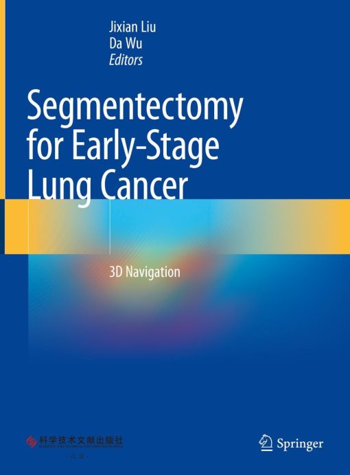 Segmentectomy for Early-Stage Lung Cancer (PDF)