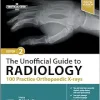 The Unofficial Guide to Radiology: 100 Practice Orthopaedic X-rays, 2nd edition (PDF)