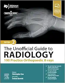 The Unofficial Guide to Radiology: 100 Practice Orthopaedic X-rays, 2nd edition (PDF)