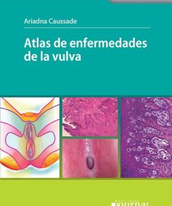 Atlas de enfermedades de la vulva (High Quality Image PDF)