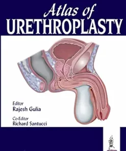 Atlas of Urethroplasty (PDF)