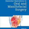 Bailey & Love’s Essential Operations in Oral & Maxillofacial Surgery (PDF)