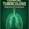 Clinical Tuberculosis: Diagnosis & Treatment: Diagnosis and Treatment (PDF)